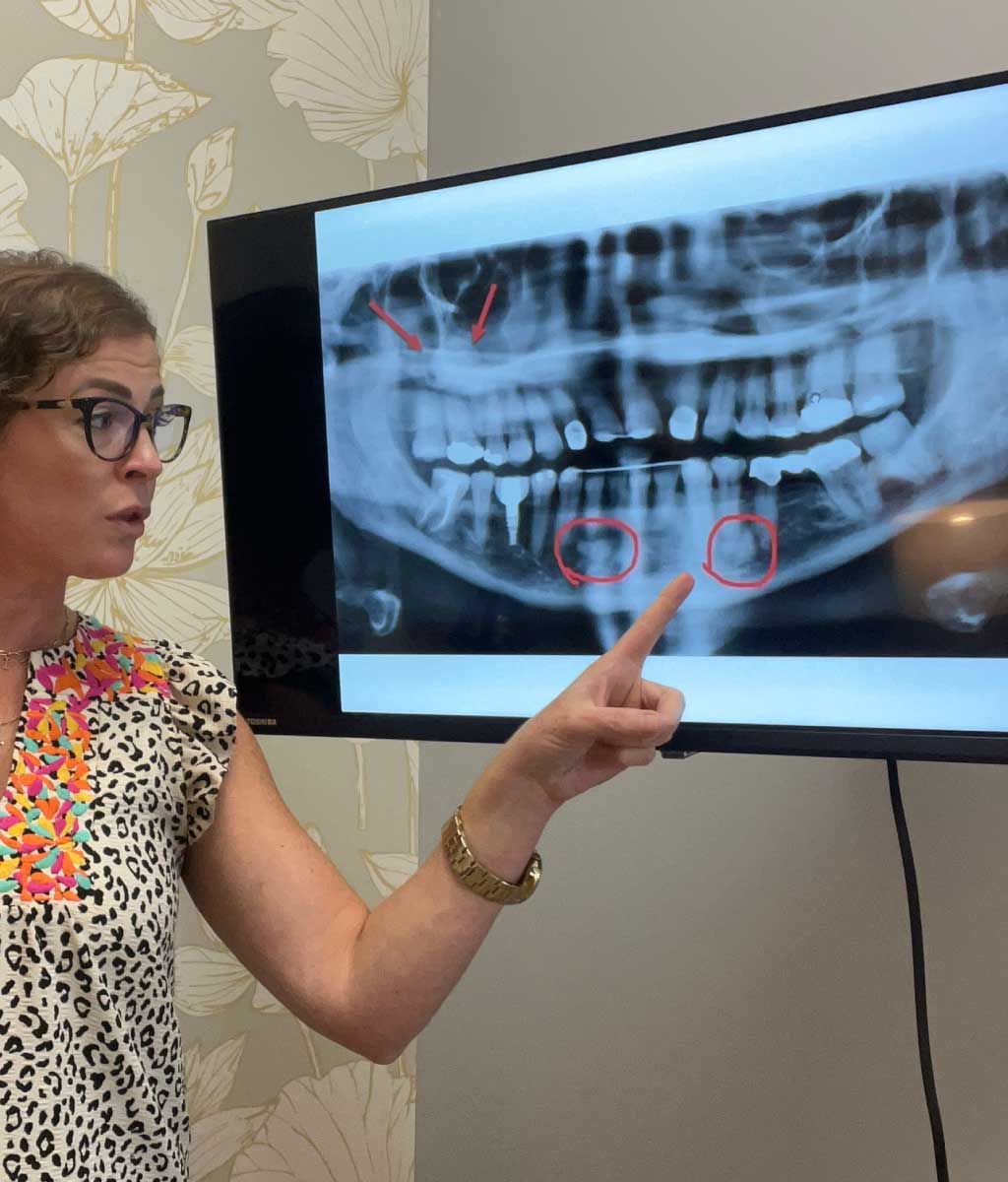 Dental Detox
